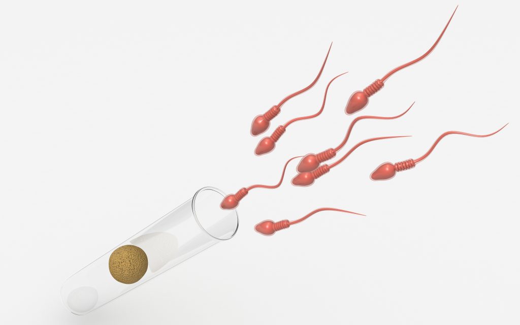 Diagnosis and Treatment of Azoospermia New Life Mexico Blog